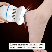 Load image into Gallery viewer, Anti-callus sander