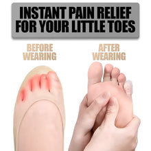 Load image into Gallery viewer, Silicone Anti-Friction Toe Protectors