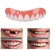Load image into Gallery viewer, Artificial Teeth Cover for a Perfect Smile