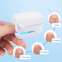 Load image into Gallery viewer, Nail Fungus Cleaning Laser Device