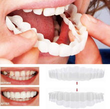Load image into Gallery viewer, Smile Veneer (Upper & Lower Included)