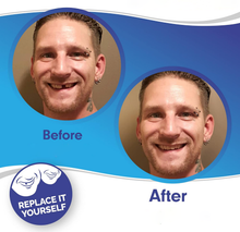 Load image into Gallery viewer, Clip On Veneer Shell with Custom Molded Silicone Strip for Upper Teeth