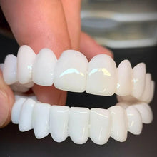 Load image into Gallery viewer, Custom Dental Prosthetics Natural Smile Restoration