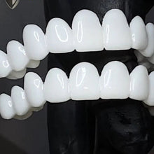 Load image into Gallery viewer, Custom Dental Prosthetics Natural Smile Restoration