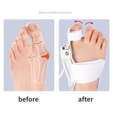 Load image into Gallery viewer, Elastic Big Toe Separator Sleeve with Gel Cushion Pad