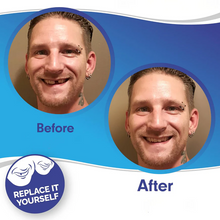 Load image into Gallery viewer, Clip On Veneers with Adjustable Fit and Natural Tooth Shade, Storage Case