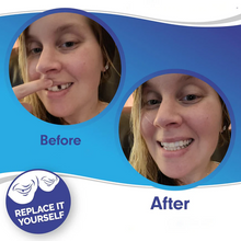 Load image into Gallery viewer, Clip On Veneers with Adjustable Fit and Natural Tooth Shade, Storage Case
