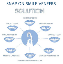 Load image into Gallery viewer, Clip On Veneers with Adjustable Fit and Natural Tooth Shade, Storage Case