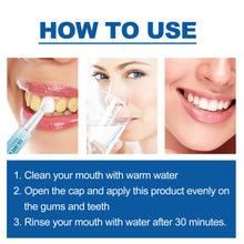 Load image into Gallery viewer, Teeth Whitening Pen