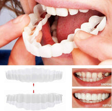 Load image into Gallery viewer, Clip On Veneers with Adjustable Fit and Natural Tooth Shade, Storage Case