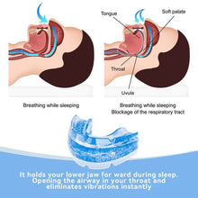Load image into Gallery viewer, Moldable Snore Mouthpiece with Screw Adjustment and Custom Fit
