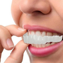 Load image into Gallery viewer, Smile Veneer (Upper & Lower Included)