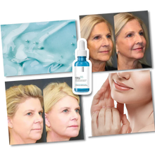 Load image into Gallery viewer, Rejuvenating Hyalu B5 Hyaluronic Acid Serum