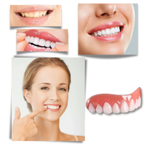 Load image into Gallery viewer, Snap-On Veneer Teeth for Instant Smile Enhancement