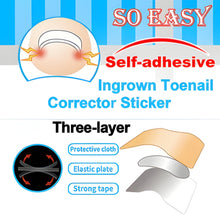 Load image into Gallery viewer, Easy Patches - Correction Patches For Beautiful And Healthy Nails
