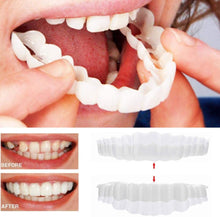 Load image into Gallery viewer, Clip On Veneer Shell with Custom Molded Silicone Strip for Upper Teeth
