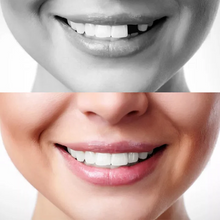 Load image into Gallery viewer, Original Moldable False Teeth
