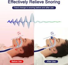 Load image into Gallery viewer, Micro CPAP Sleep Apnea Machine For Travel &amp; Anti Snoring - CPAP Alternative
