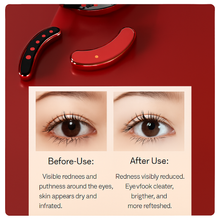 Load image into Gallery viewer, Mini Eye Massager with EMS Microcurrent and Gentle Heat Therapy for Dark Circles and Wrinkle Care
