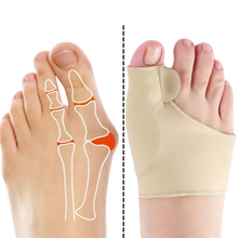 Load image into Gallery viewer, Gel Bunion Corrector Toe Straightener for Bunion Pain Relief
