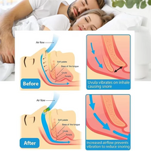 Load image into Gallery viewer, Magnetic Anti Snore Device Nose Clip for Better Breathing and Restful Sleep with Case
