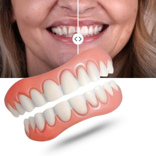 Load image into Gallery viewer, Denture Solution for Comfortable, Secure Fit
