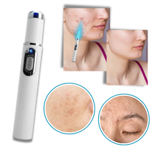 Load image into Gallery viewer, Dark Spot Remover Pen for Scars and Hyperpigmentation
