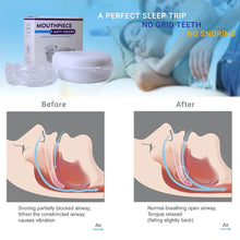 Load image into Gallery viewer, Anti Snore Mouthpiece – Comfortable Snoring Mouth Guard for Peaceful Sleep
