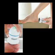 Load image into Gallery viewer, Electric Callus Remover
