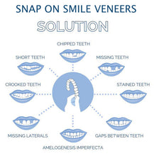 Load image into Gallery viewer, Clip On Veneer Shell with Custom Molded Silicone Strip for Upper Teeth
